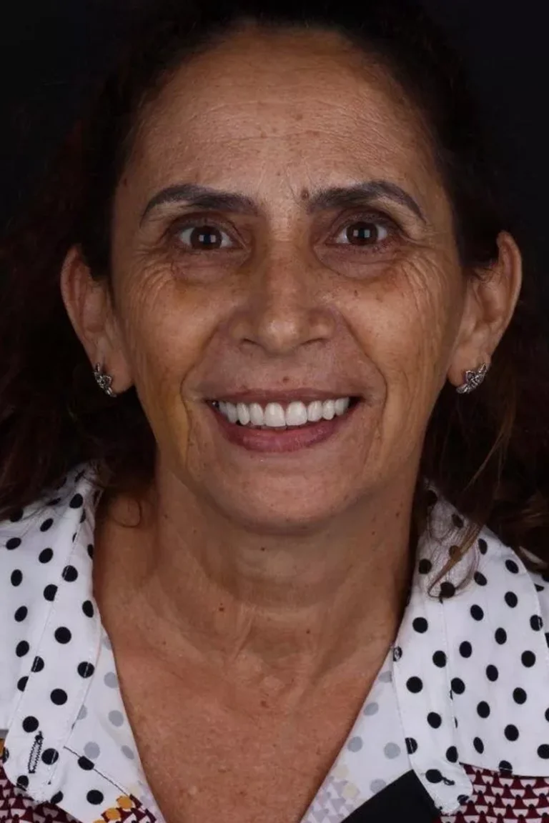 Depois